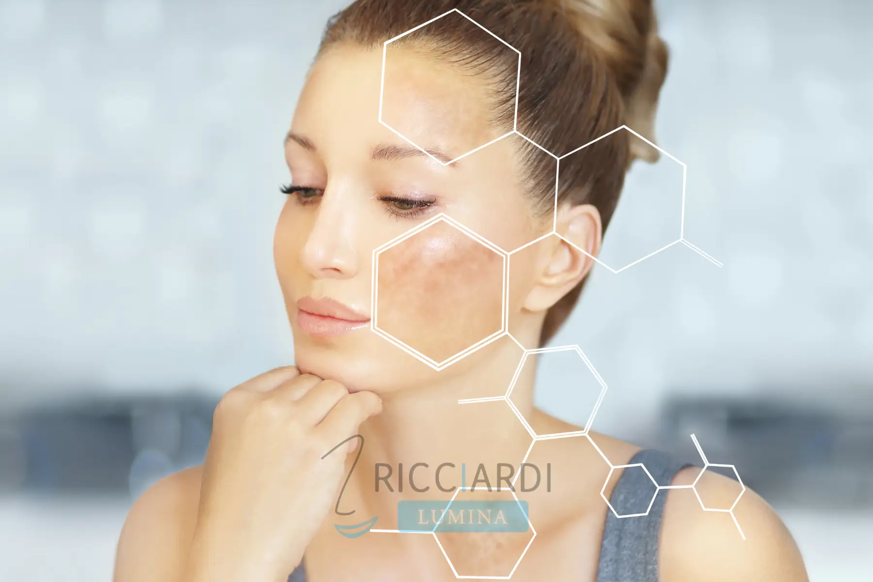 Rimozione Macchie Solari