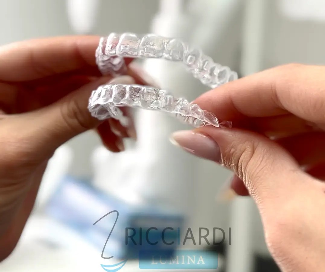 Allineatori Trasparenti