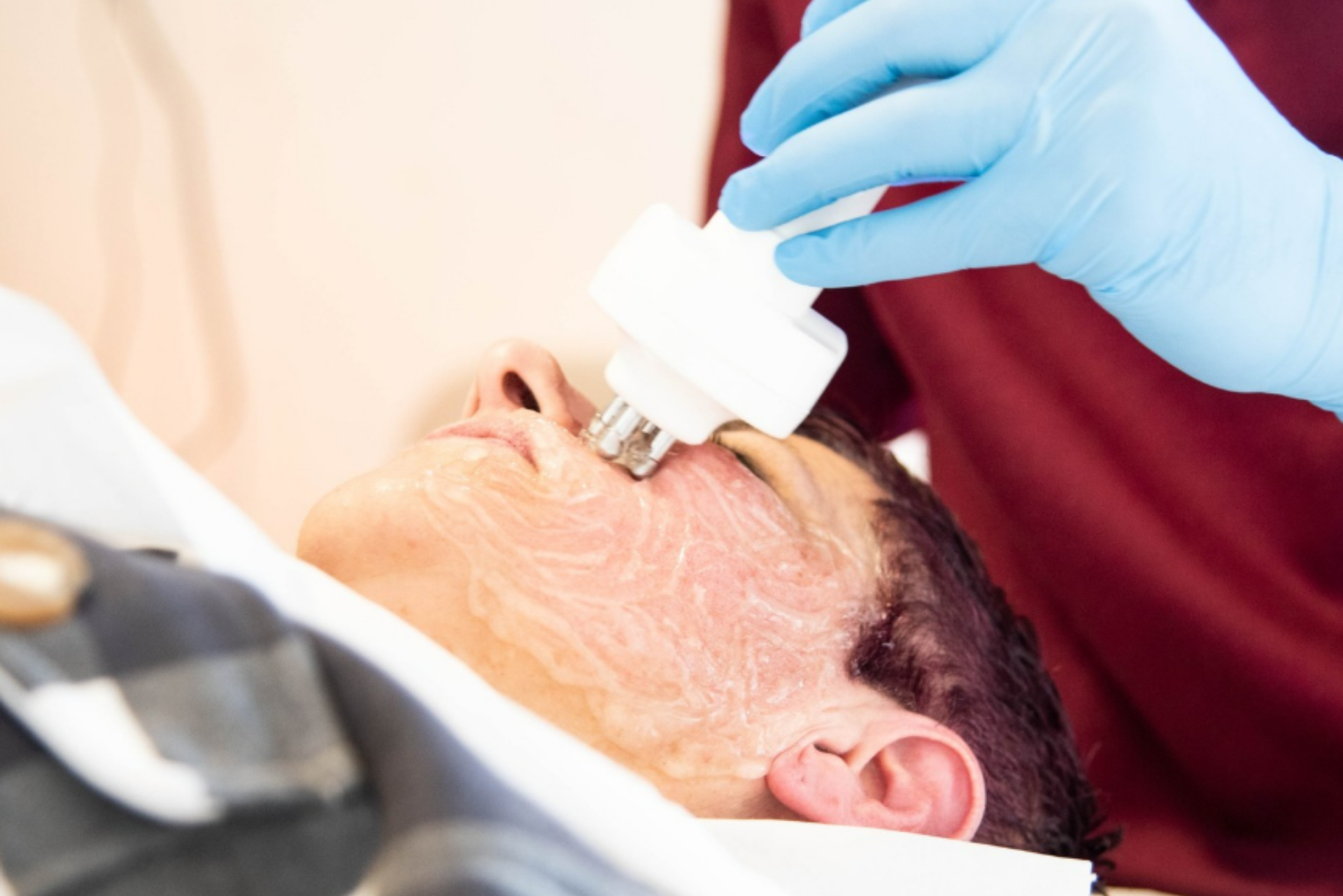 Vedi una paziente sdraiata sul lettino con un gel sul viso. Una persona dello staff dello Studio Dentistico Ricciardi indossa guanti azzurri e lavora con un dispositivo sulla zona occhi e fronte. La scena mostra un trattamento di medicina estetica non invasiva del percorso Total Lift.